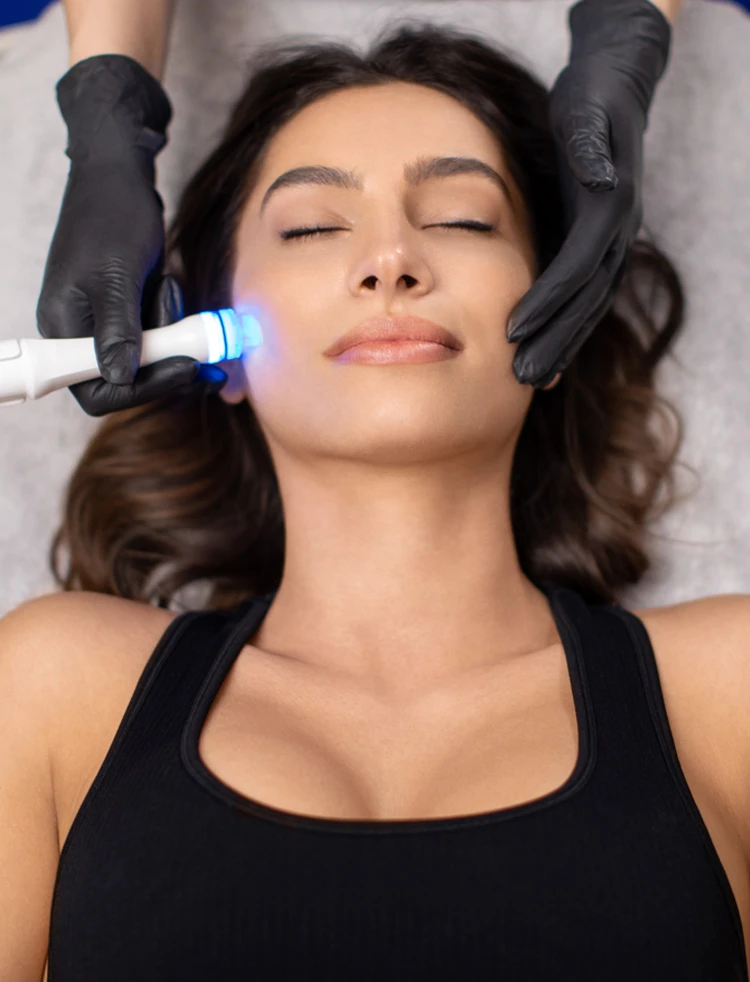 IPL photofacial- how much